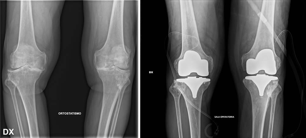 ForoPrePost2.jpg (37 KB)